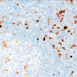 Lysozyme Rabbit Monoclonal Antibody(ARM520)