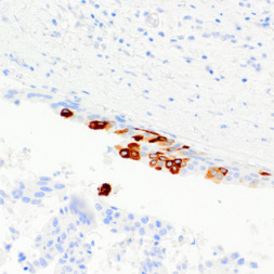 Mammaglobin Rabbit Monoclonal Antibody(ARM522)