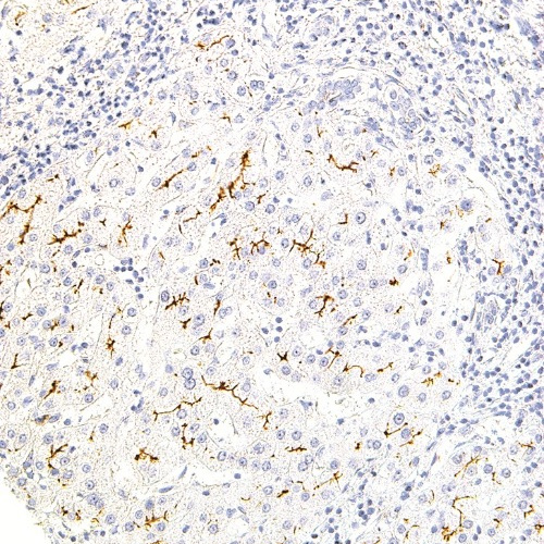 MDR3 Mouse Monoclonal Antibody(ARM524)