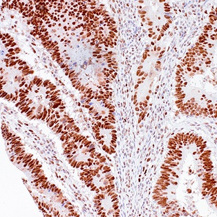 MSH2 Mouse Monoclonal Antibody(ARM527)