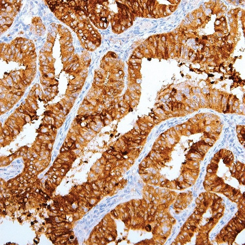 MUC1/EMA Mouse Monoclonal Antibody(ARM528)