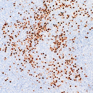 MUM1 Mouse Monoclonal Antibody(ARM530)