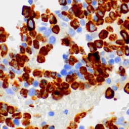 Myeloperoxidase Rabbit Monoclonal Antibody(ARM531)