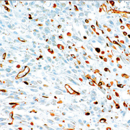 Nestin Rabbit Monoclonal Antibody(ARM536)