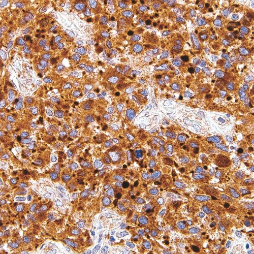 Neurofilament Mouse Monoclonal Antibody(ARM537)