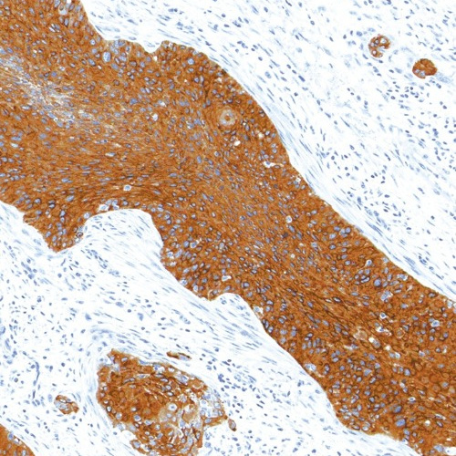 p120 Catenin Mouse Monoclonal Antibody(ARM541)