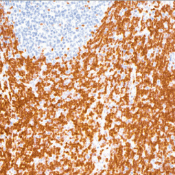 p27 Mouse Monoclonal Antibody(ARM543)
