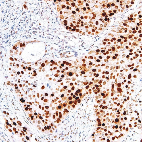 p53 Mouse Monoclonal Antibody(ARM544)