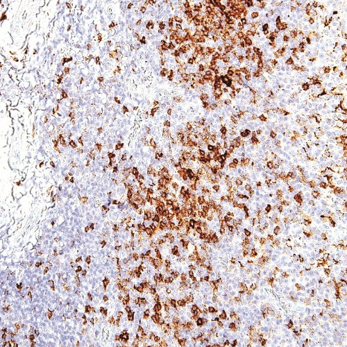 PD-1 Mouse Monoclonal Antibody(ARM549)