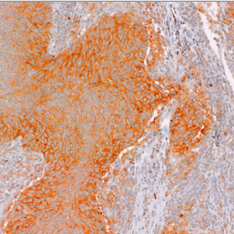 PD-L1-IMF Rabbit Monoclonal Antibody(ARM550)