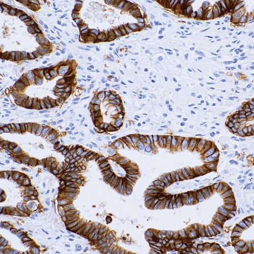PD-L1-TEC Rabbit Monoclonal Antibody(ARM551)