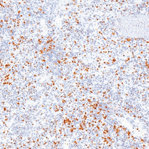 Perforin Mouse Monoclonal Antibody(ARM552)