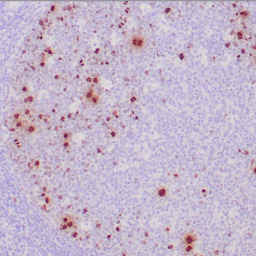 Phosphohistone H3 (PHH3) Mouse Monoclonal Antibody(ARM554)