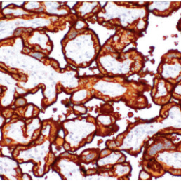 PLAP Rabbit Monoclonal Antibody(ARM555)