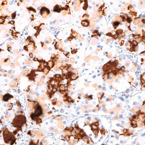 Prolactin Mouse Monoclonal Antibody(ARM556)