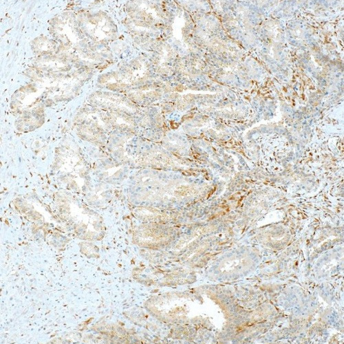 PTEN Rabbit Monoclonal Antibody(ARM558)