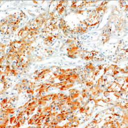 RCC Mouse Monoclonal Antibody(ARM559)