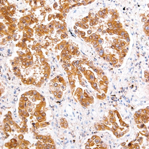 ROS1 Rabbit Monoclonal Antibody(ARM560)