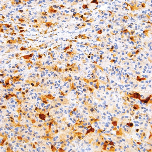 S-100 Mouse Monoclonal Antibody(ARM561)