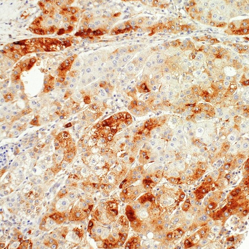 SAA1 Mouse Monoclonal Antibody(ARM562)