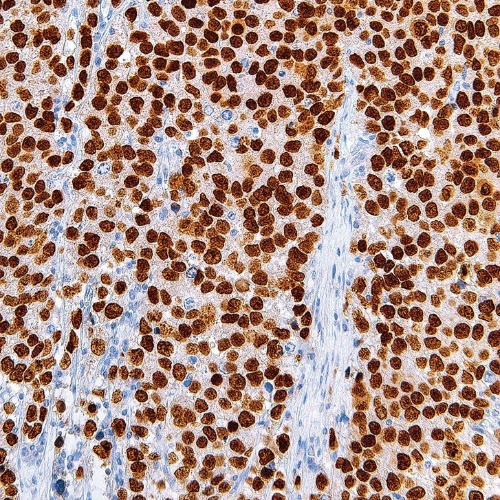 SALL4 Mouse Monoclonal Antibody(ARM563)