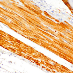 Smoothelin Mouse Monoclonal Antibody(ARM564)