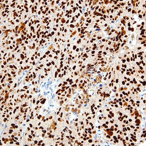 SOX-10 Mouse Monoclonal Antibody(ARM565)