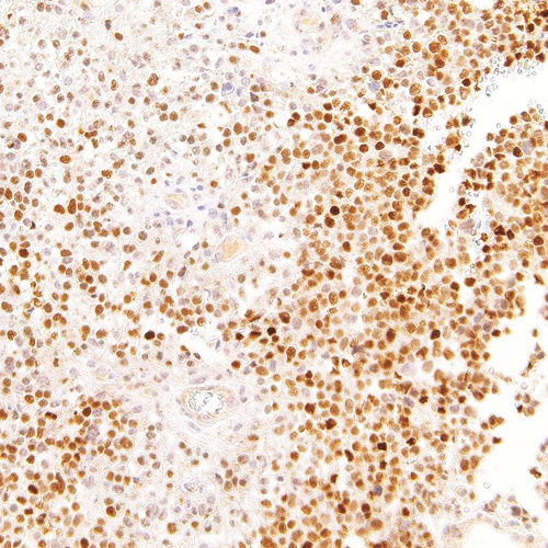 SOX-11 Mouse Monoclonal Antibody(ARM566)