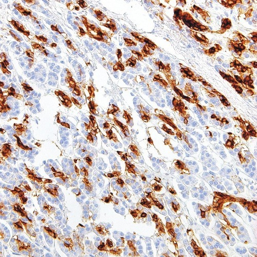 SPNS2 Mouse Monoclonal Antibody(ARM568)
