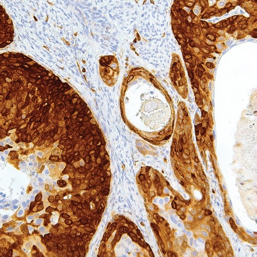 Stathmin Mouse Monoclonal Antibody(ARM570)