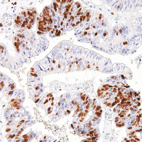 Survivin Mouse Monoclonal Antibody(ARM571)