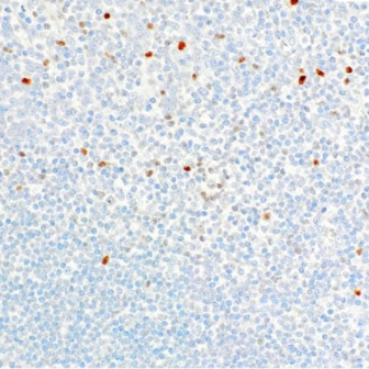 TIA-1 Mouse Monoclonal Antibody(ARM578)