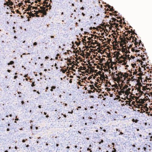 TOP2A Mouse Monoclonal Antibody(ARM581)