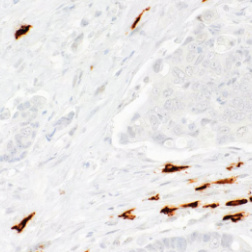 Tryptase Mouse Monoclonal Antibody(ARM582)