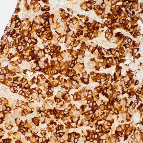 TSH Mouse Monoclonal Antibody(ARM583)
