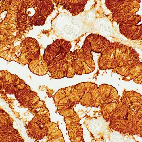 Villin Mouse Monoclonal Antibody(ARM584)