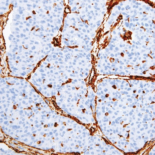 Vimentin Mouse Monoclonal Antibody(ARM585)