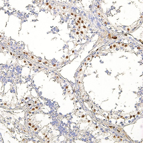 WT1 Mouse Monoclonal Antibody(ARM586)