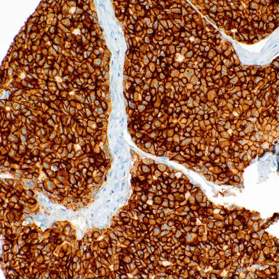 C-Met Rabbit Monoclonal Antibody(ARM587)