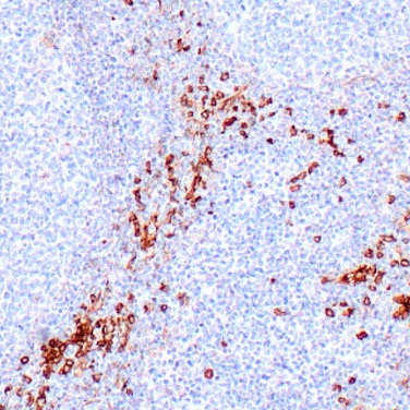CD123 Mouse Monoclonal Antibody(ARM588)