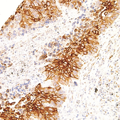 TAG-72(B72.3) Mouse Monoclonal Antibody(ARM572)