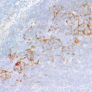 C4d Rabbit Monoclonal Antibody(ARM591)