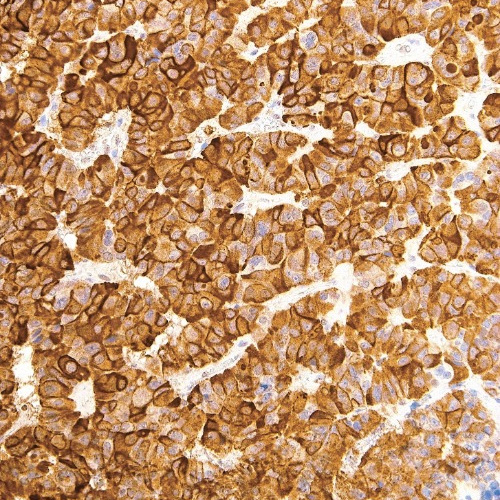 Luteinizing Hormone (LH) Mouse Monoclonal Antibody(ARM593)