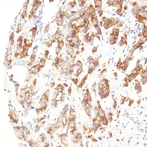 B7H4 Mouse Monoclonal Antibody(ARM599)