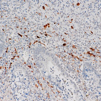 Calretinin Mouse Monoclonal Antibody(ARM601)