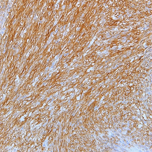 CD117 Rabbit Monoclonal Antibody(ARM602)