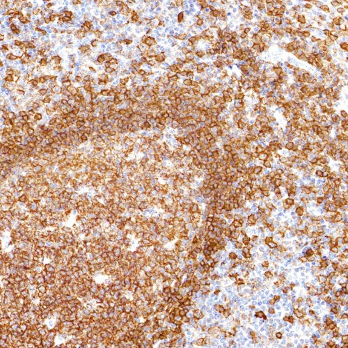 CD19 Mouse Monoclonal Antibody(ARM604)