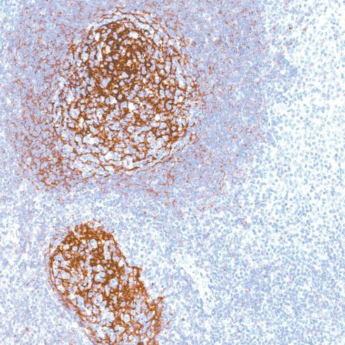 CD21 Mouse Monoclonal Antibody(ARM605)