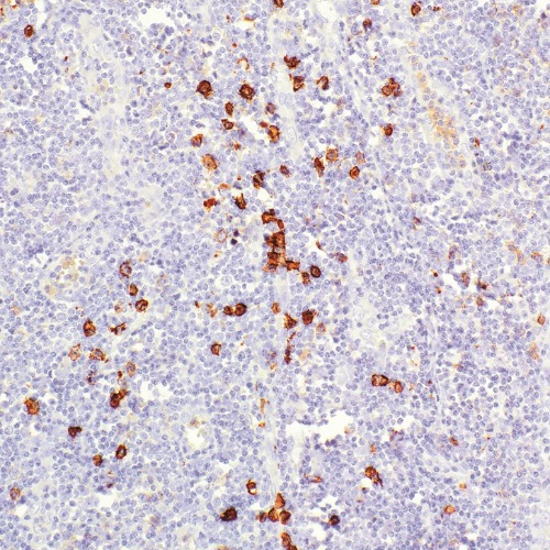 CD38 Rabbit Monoclonal Antibody(ARM607)