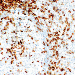 CD7 Rabbit Monoclonal Antibody(ARM608)